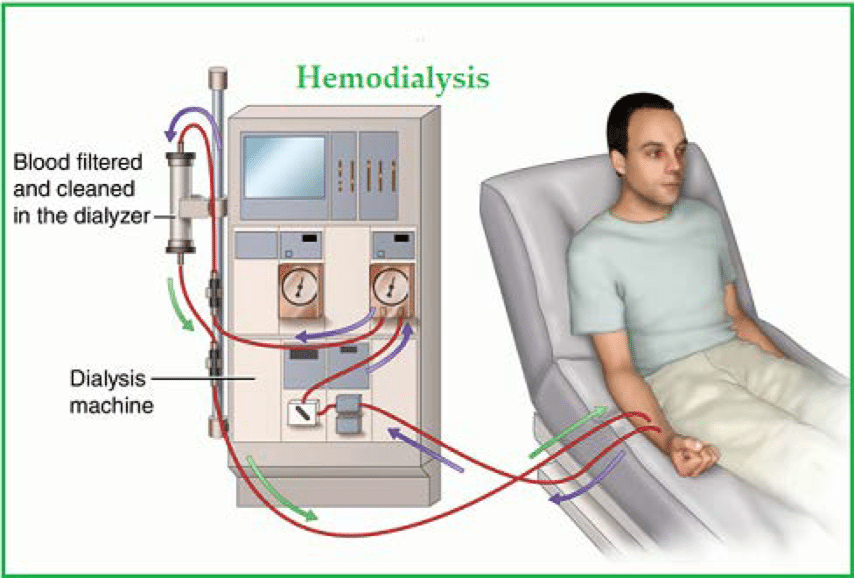 Hemodialysis